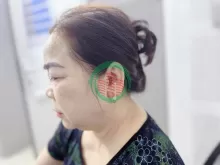 Chọn máy trợ thính địa chỉ uy tín,chính hãng thanh hóa.