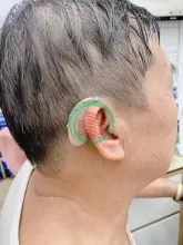 Máy trợ thính - thay đổi cả cuộc đời