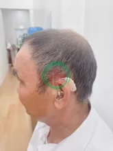 Ở Thái Bình mua máy trợ thính chính hãng ở đâu
