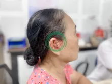 Máy trợ thính Thanh Hóa bán máy trợ thính OTICON.