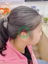 Nghe kém ở người trẻ - đừng nghĩ còn trẻ không sao