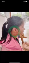 Ù tai nhưng vẫn nghe được có cân đi khám không